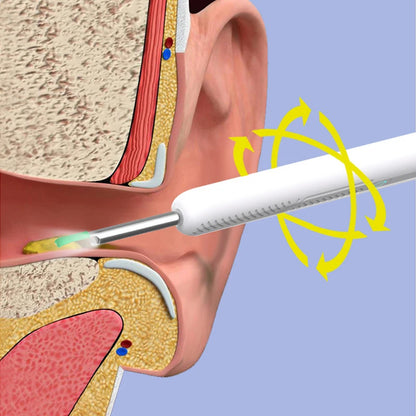 Ear cleaning tool with LED light and smartphone connection