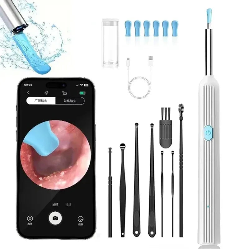 SmartEar Scope
