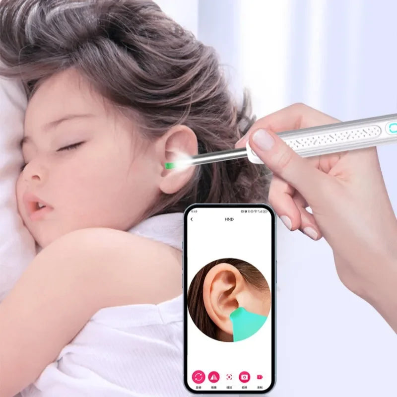 SmartEar Scope